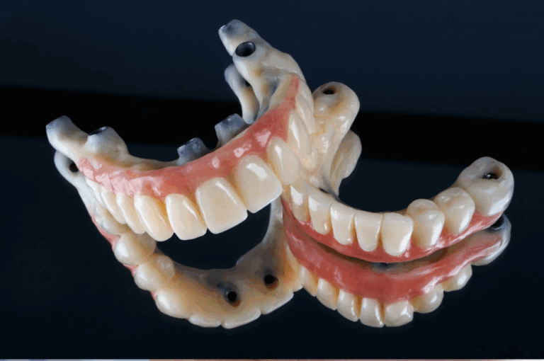 Implant 3