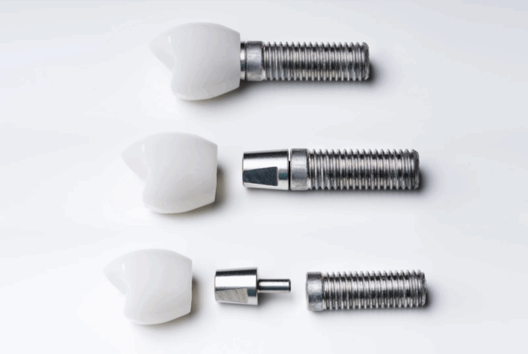 Implant 4